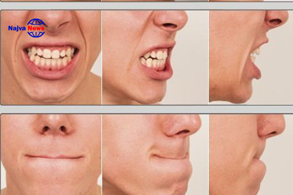 حالات دهان در آموزش زبان بدن
